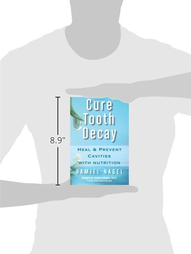 Cure Tooth Decay: Heal and Prevent Cavities with Nutrition, 2nd Edition
